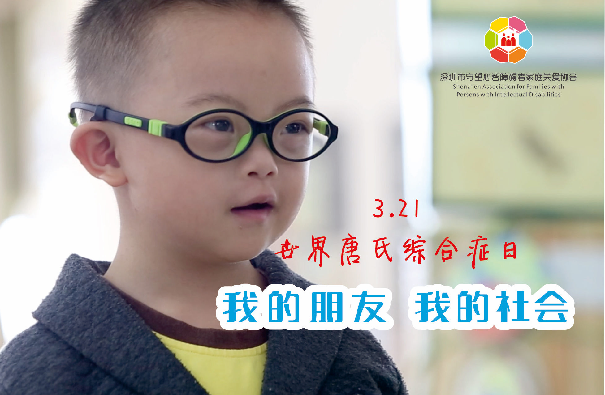 唐氏综合征的出现究竟与哪些病因有关呢？北京天使儿童医院 - 哔哩哔哩